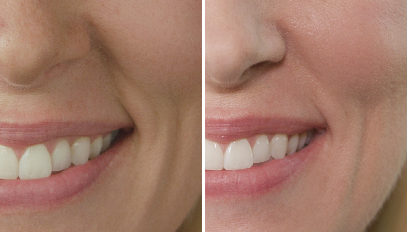 4 antiaging benefits of Red Algae in skincare Tiffany Andersen